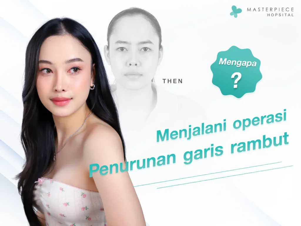 Mengapa Harus Menggeser Garis Rambut dan Mengecilkan Dahi