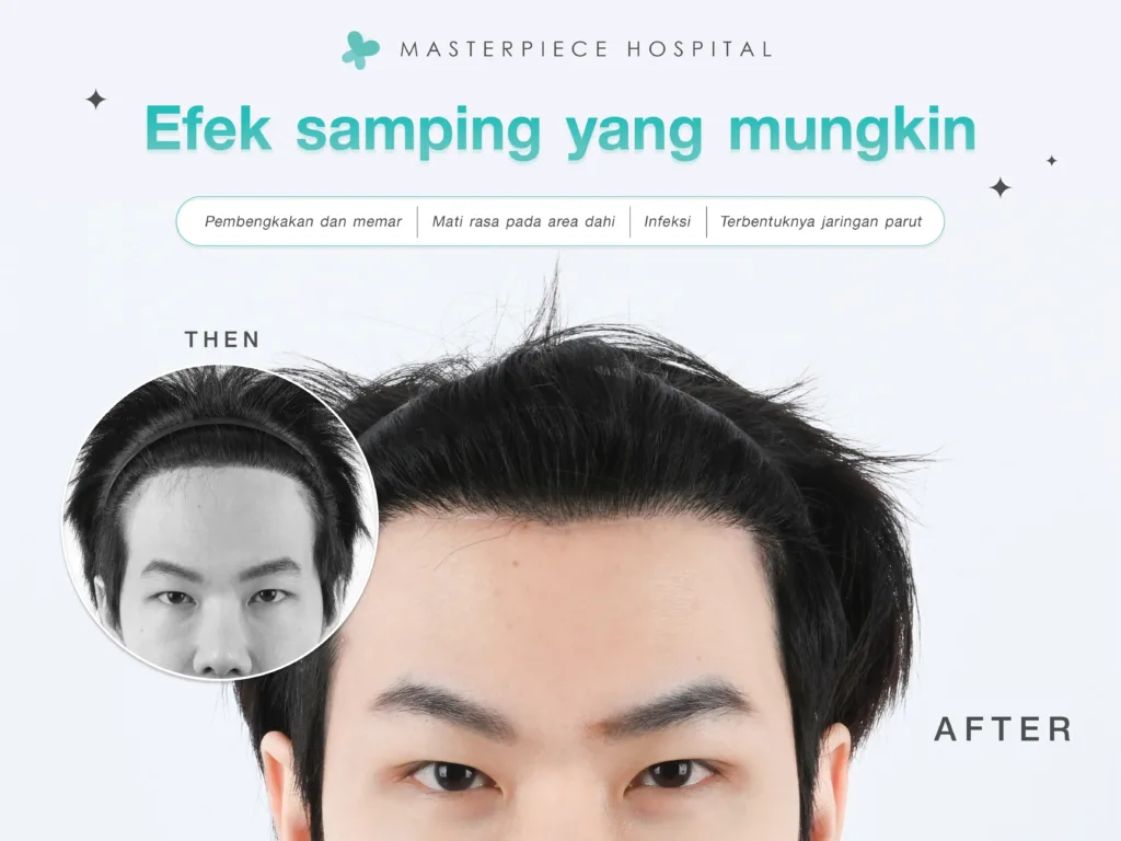 Efek Samping yang Mungkin Terjadi