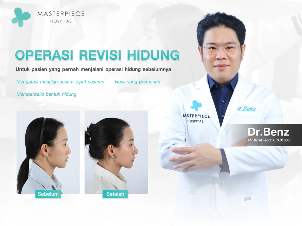 Metode Operasi bagi Mereka yang Pernah Melakukan Rhinoplasty