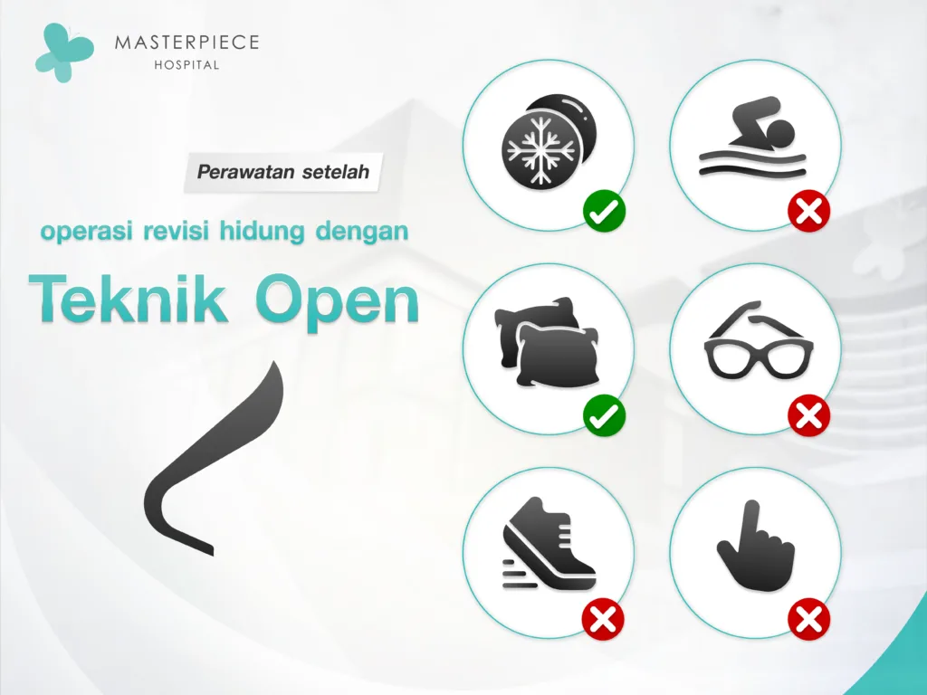 Perawatan Setelah Rhinoplasty Open