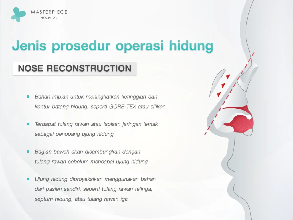 Jenis prosedur operasi hidung