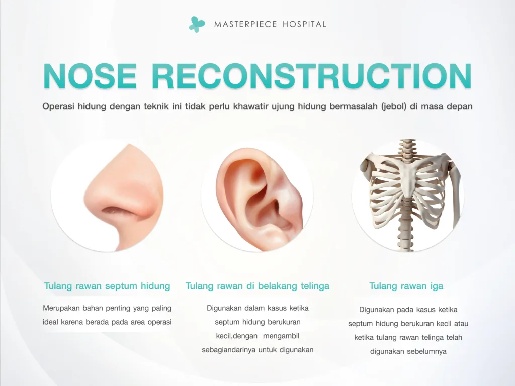 NOSE RECONSTRUCTION