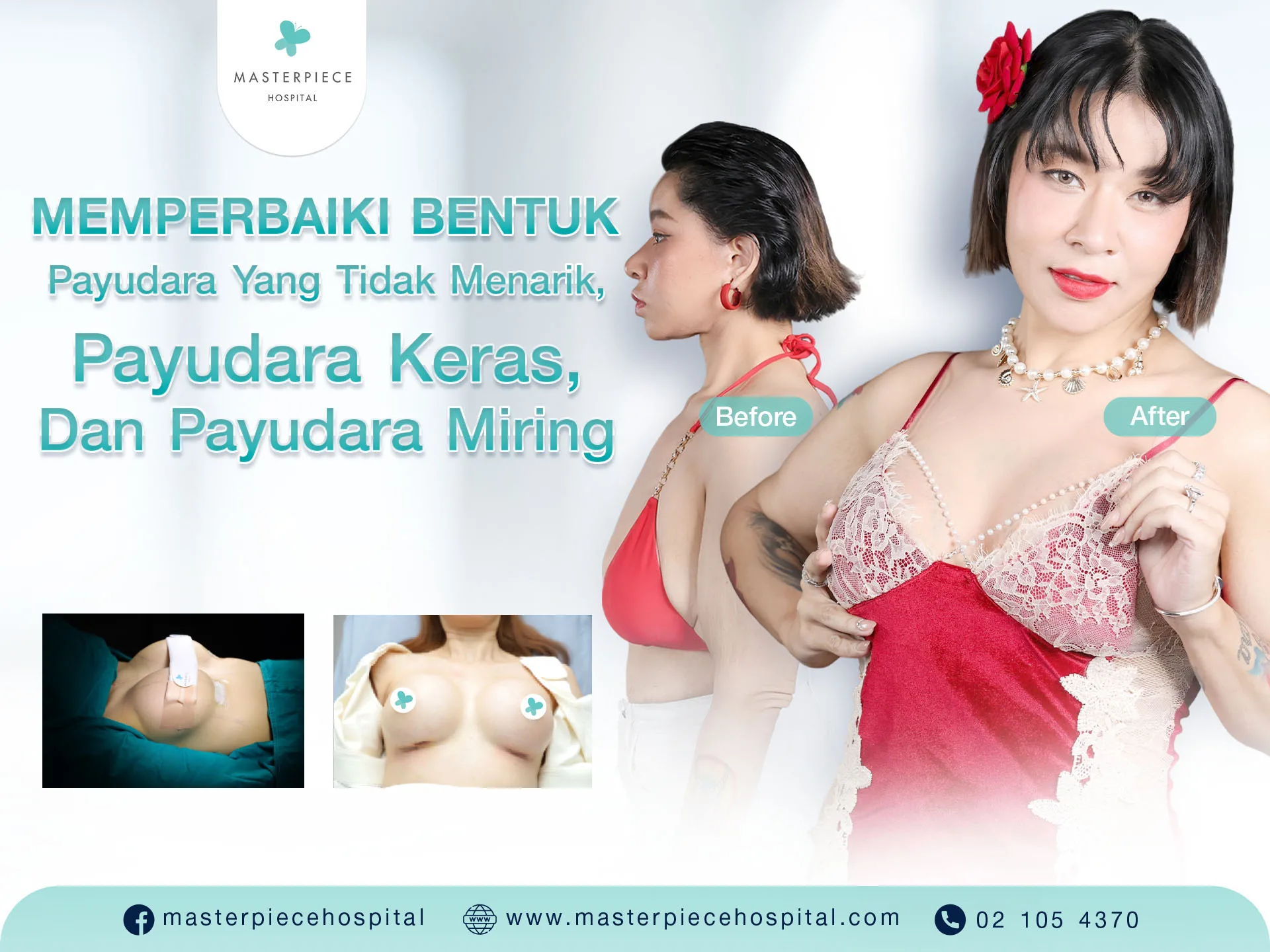 Memperbaiki Bentuk Payudara Yang Tidak Menarik, Payudara Keras, Dan Payudara Miring