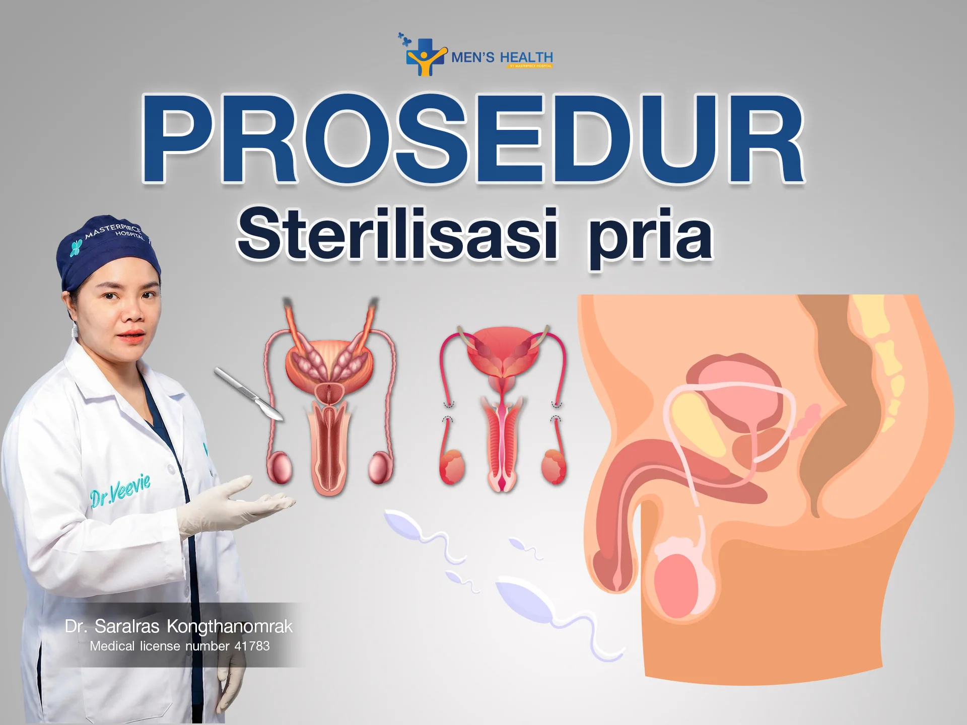 Prosedur Vasektomi (Sterilisasi Pria)