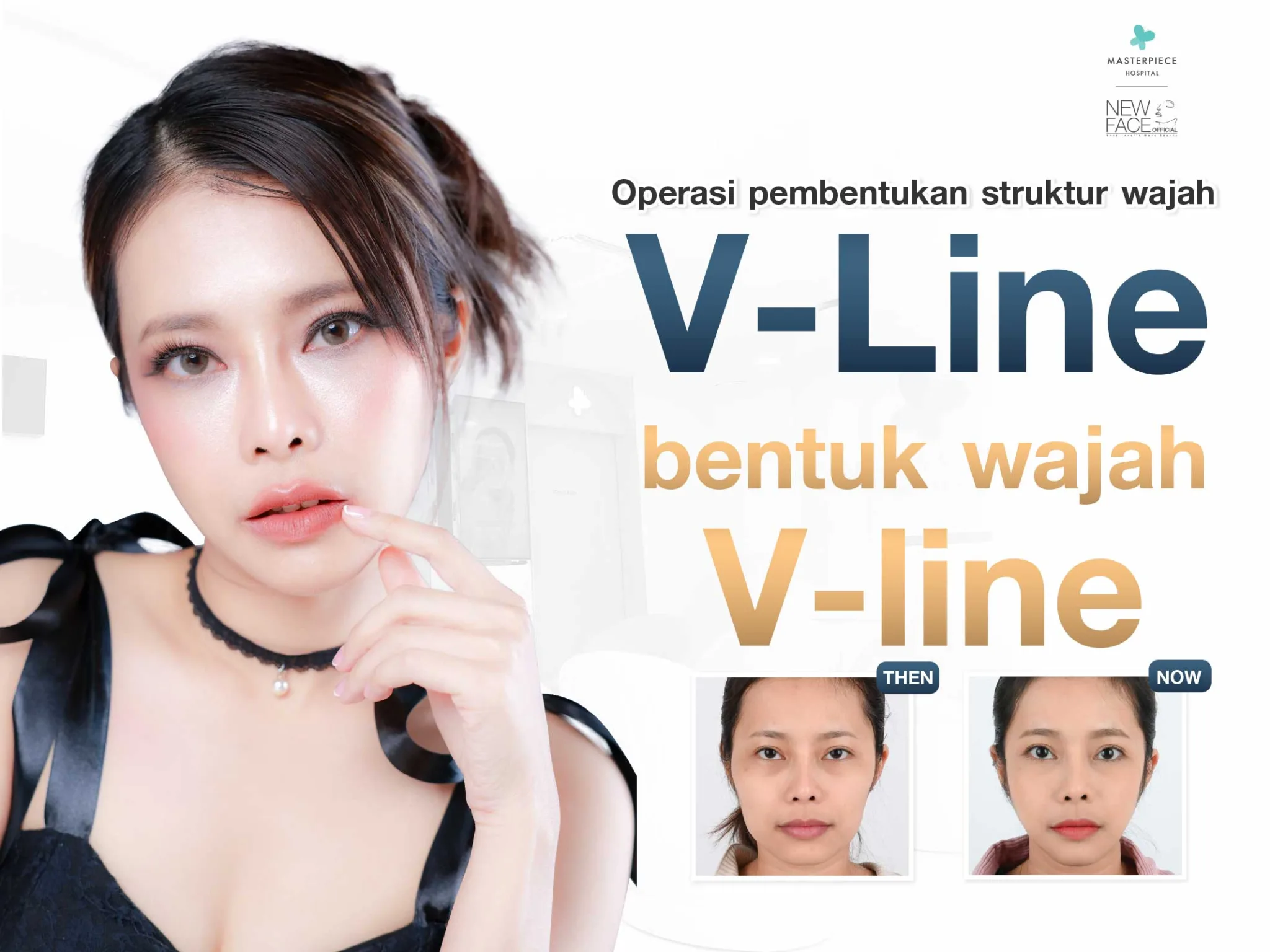 V Line – Operasi Kontur Wajah 3 Titik