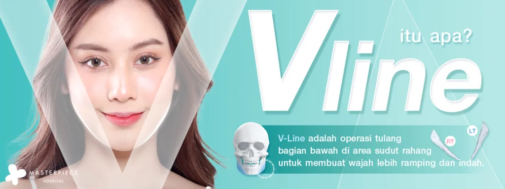 Apa itu V Line?