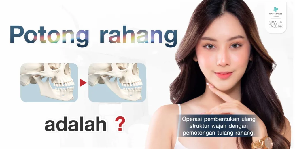 Apa itu Operasi Rahang?