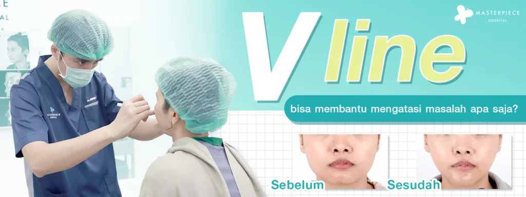 Masalah yang Dapat Diperbaiki oleh Operasi V Line 3 Titik