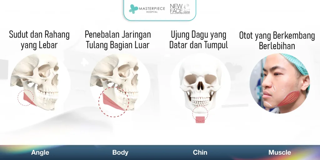 Meniruskan Pipi dan Memotong Rahang