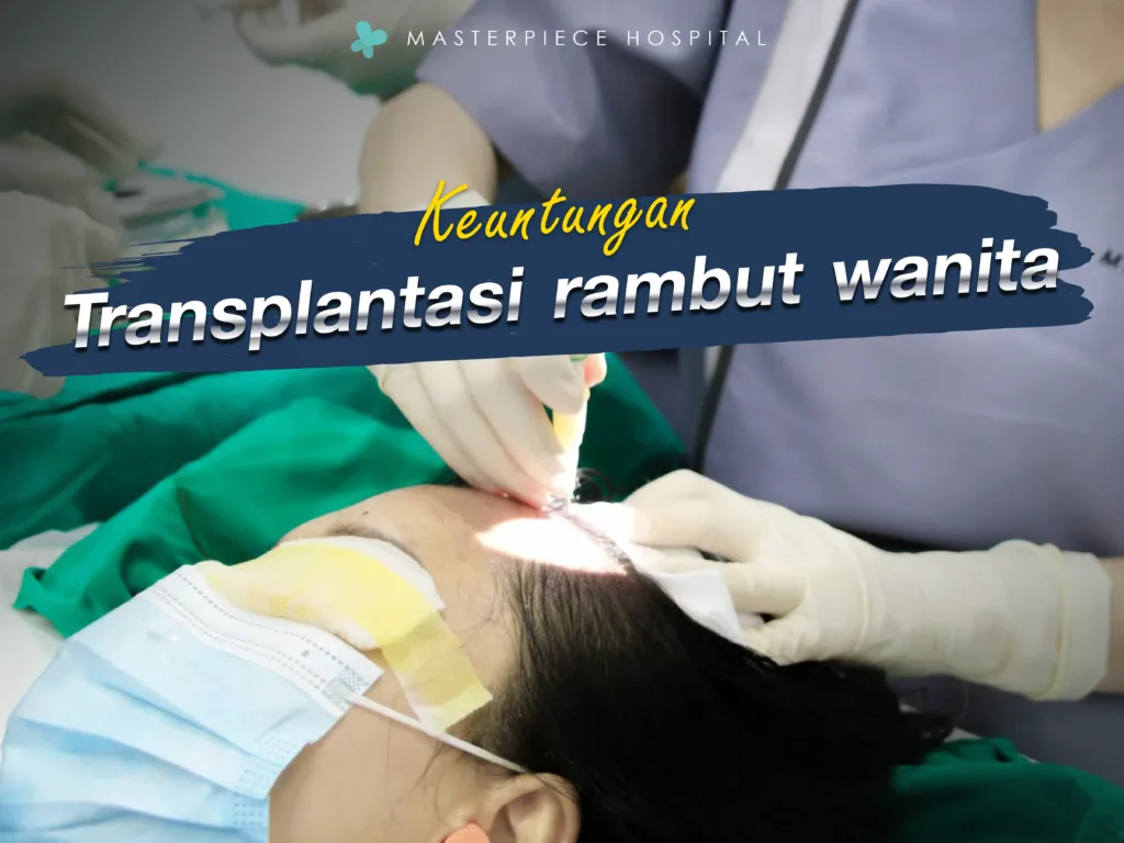 Kelebihan Transplantasi Rambut Wanita