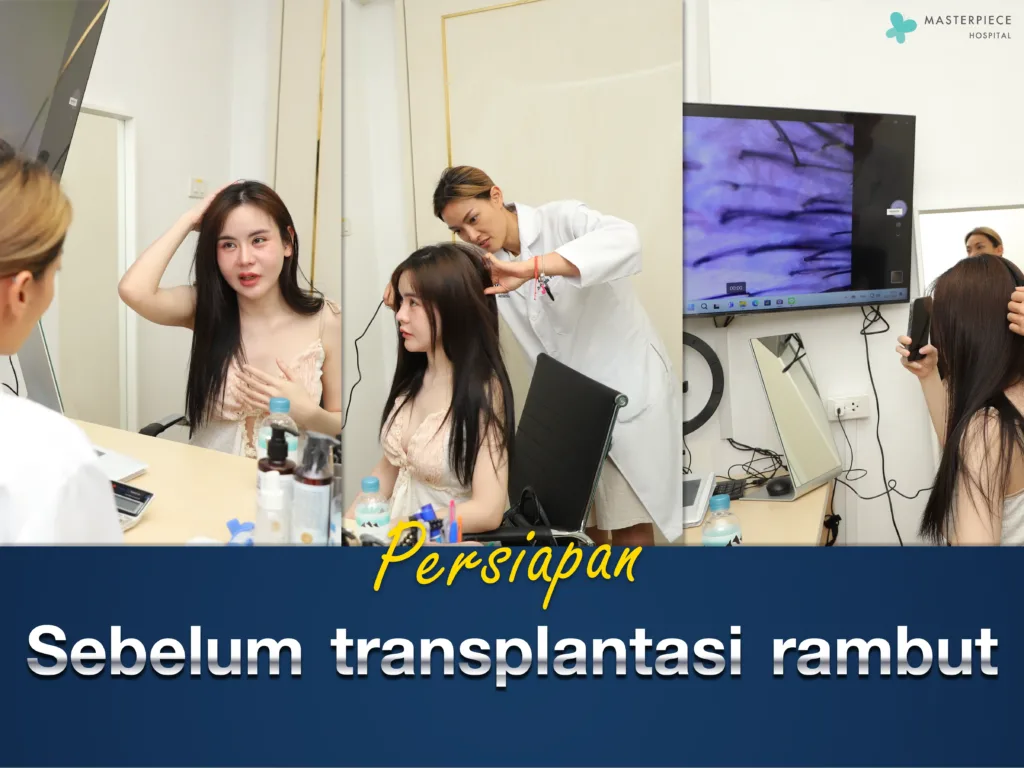 Persiapan Sebelum Transplantasi Rambut Wanita