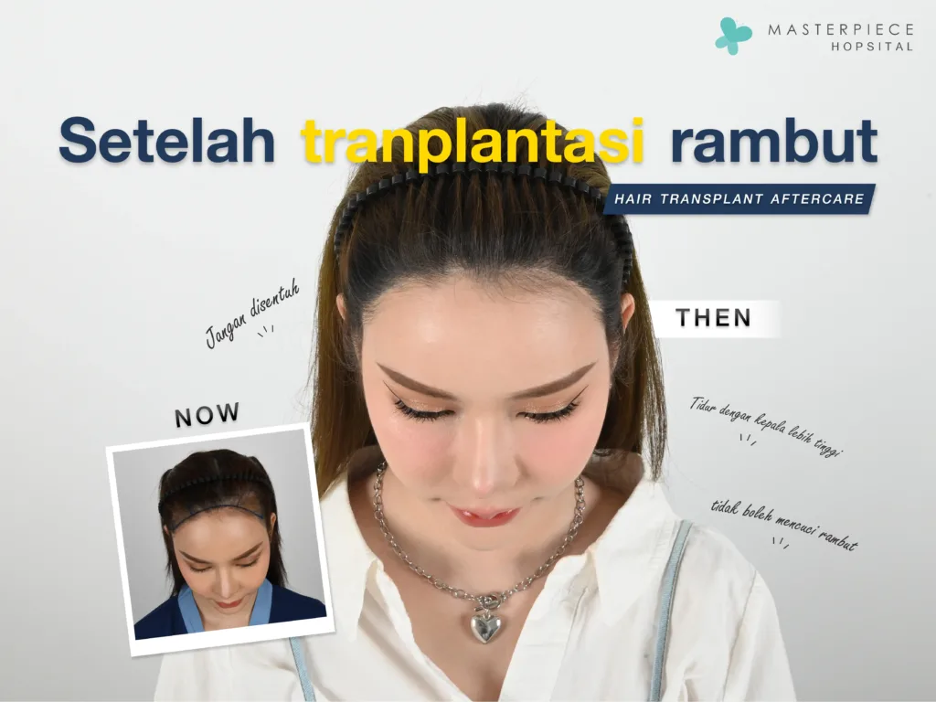 Perawatan Setelah Transplantasi Rambut Wanita