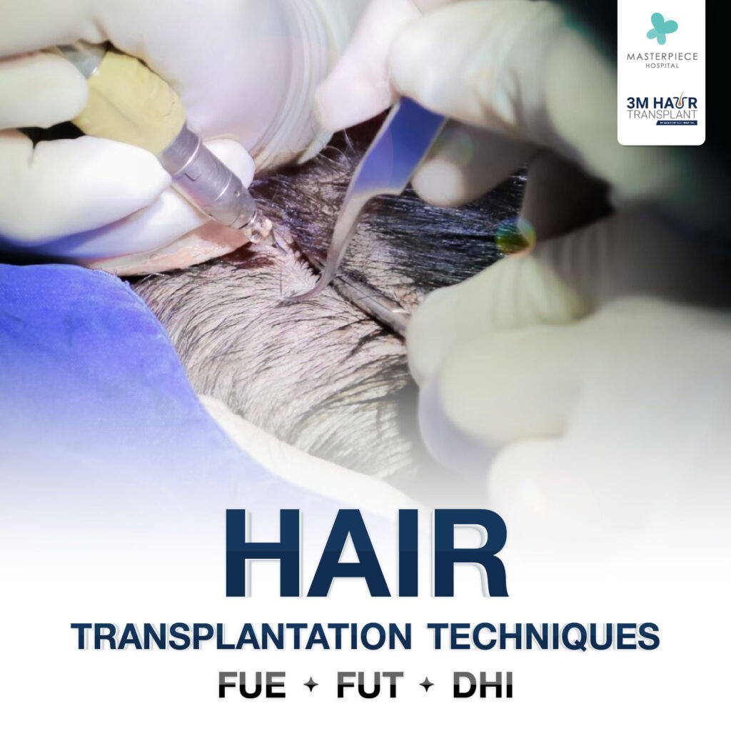 Teknik transplantasi rambut yang perlu Anda ketahui