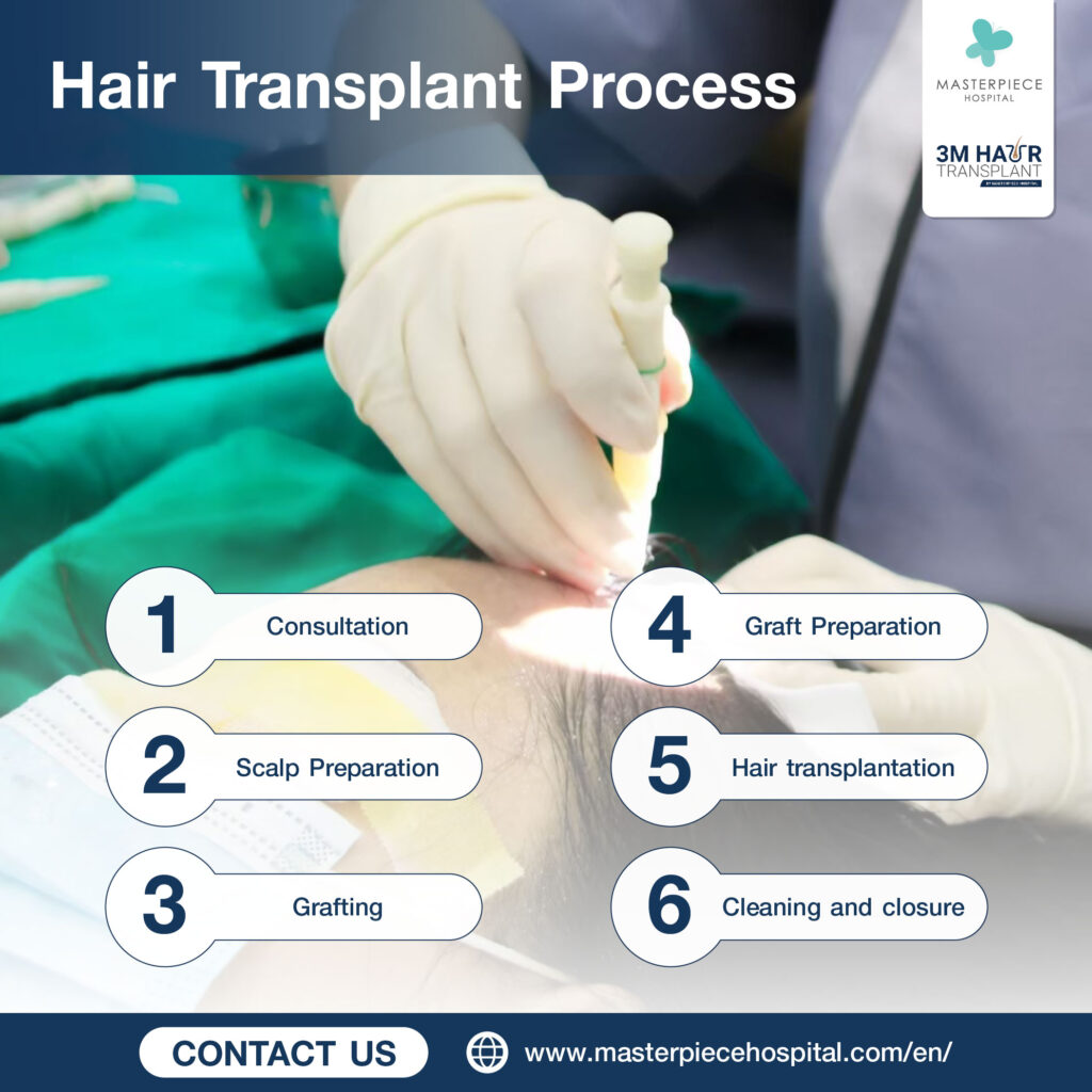 Prosedur transplantasi rambut
