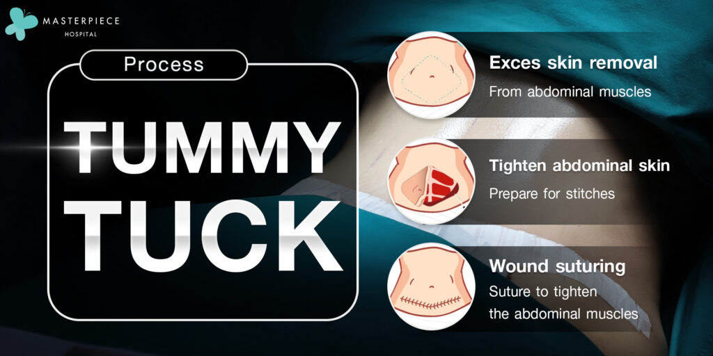 Proses Pemotongan Kulit Perut