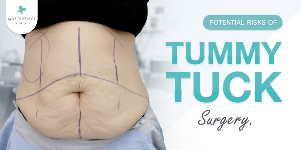 Risiko potensial dan cara mencegahnya