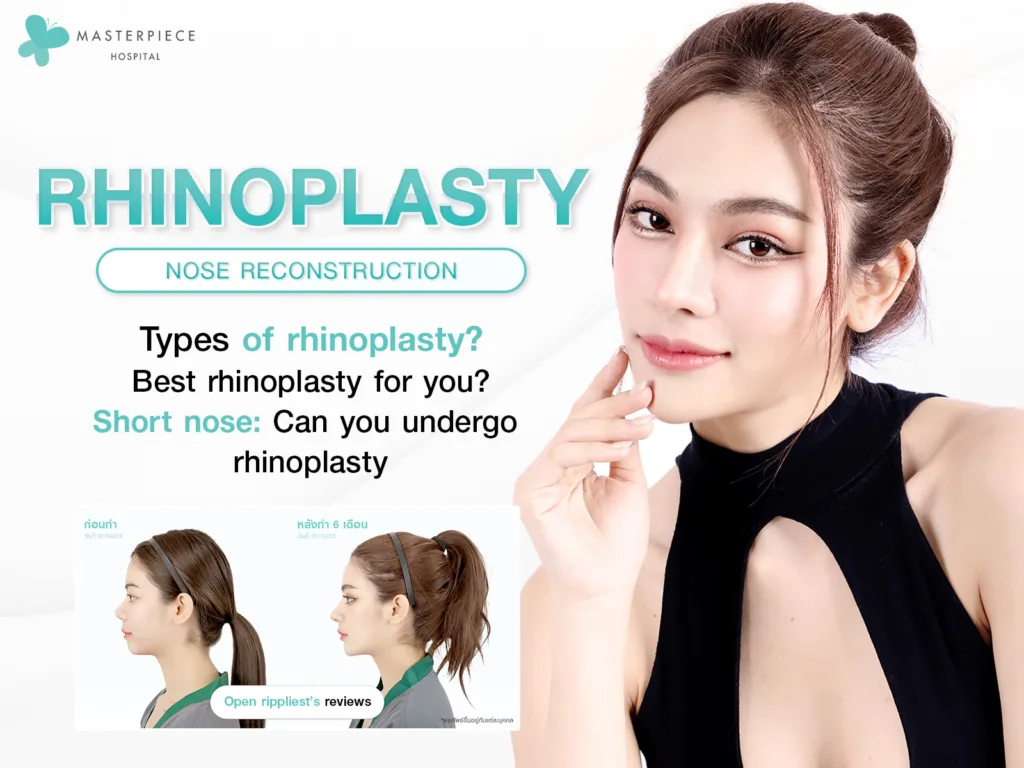 Operasi rinoplasti untuk membuat hidung Anda terlihat indah dan menonjol dengan tampilan berdimensi. Jika Anda ingin tampil cantik dan menarik perhatian, Anda harus mengetahui prosedur ini.